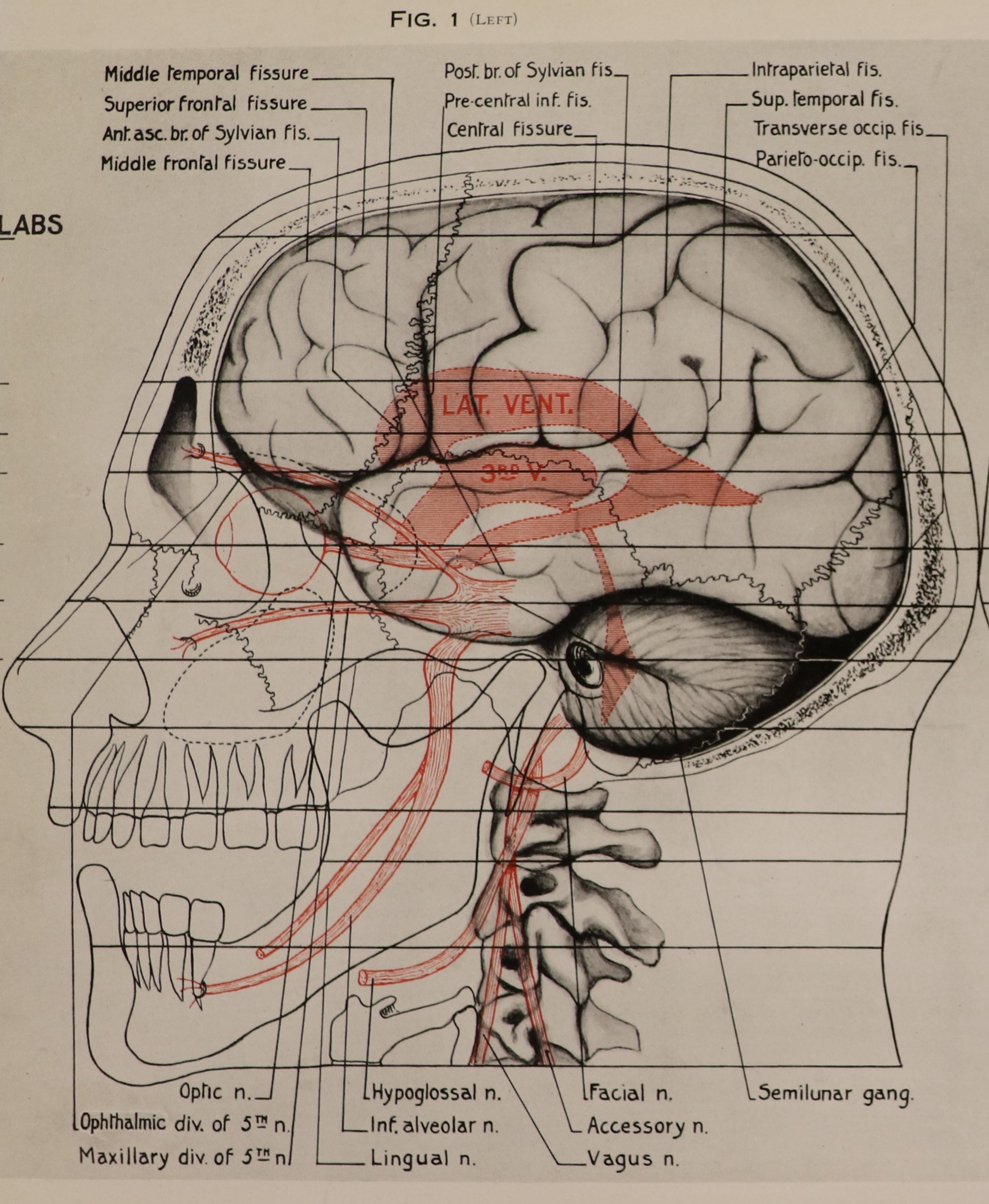 Link to Symington’s Head, Neck, and Trunk Atlas