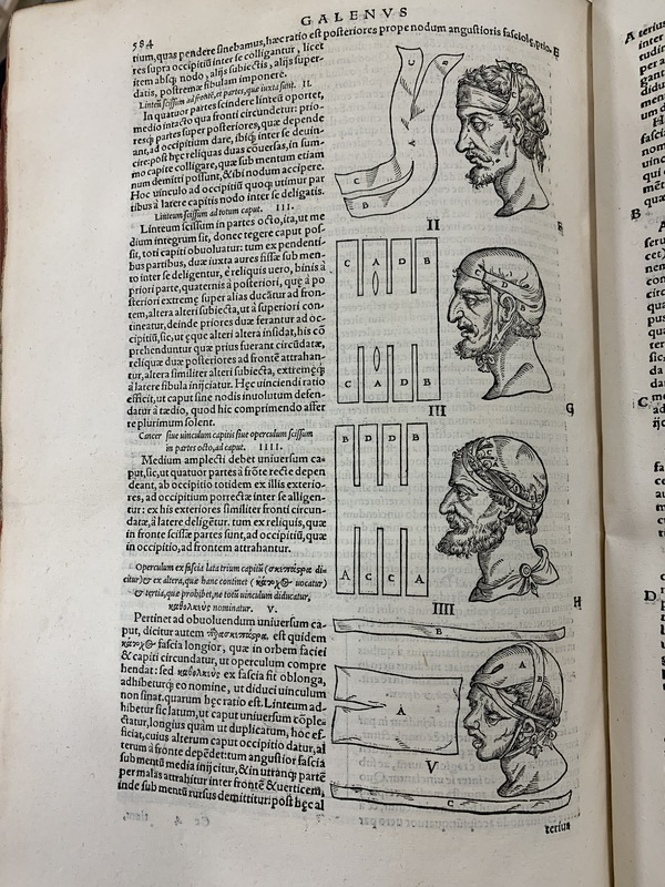 An photo of an old open book, showing a page of Latin text and illustrations of head wrappings.
